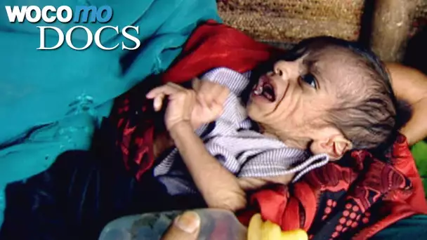 Eritrea: Schwangere und Säuglinge in Lebensgefahr