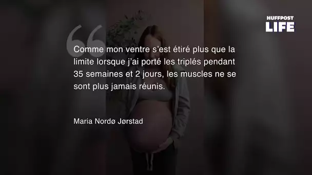 Deux ans après sa grossesse, cette mère de triplés partage l'évolution de son ventre