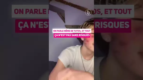 Le Cicatrice Challenge : le pire challenge de TikTok ?