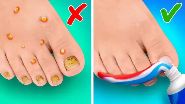 ASTUCES ET GADGETS BRILLANTS POUR LES PIEDS QUI VONT TE FACILITER LA VIE