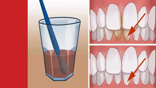 Voici Comment Supprimer les Plaques Dentaires et Blanchir Vos dents Grâce Aux Bicarbonate De Soude