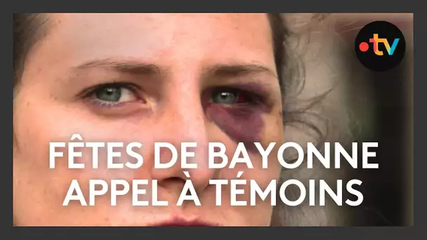 Agression d'une jeune femme pendant les Fêtes de Bayonne