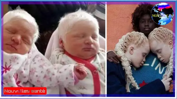 Des jumelles albinos émerveillent le monde avec leurs cheveux plus blancs que la neige