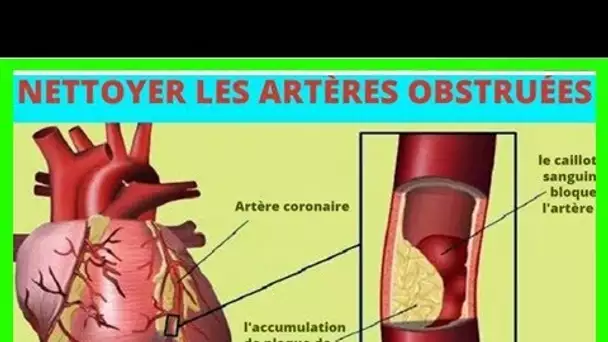 Ces aliments protègent votre coeur et débouchent vos artères