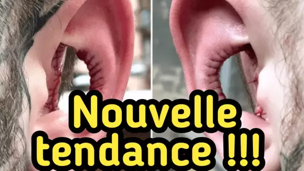 Il Veut Lancer Une Nouvelle Mode Et Se Fait Enlever L’intérieur Des Oreilles