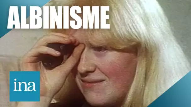 1988 : Être albinos en France | Archive INA