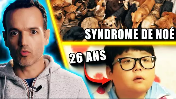 8 des syndromes les plus bizarres du cerveau (épisode 2)