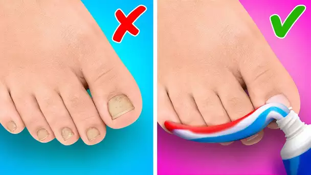 INCROYABLES GADGETS ET ASTUCES POUR LES PIEDS || IDÉES DIY POUR TES CHAUSSURES