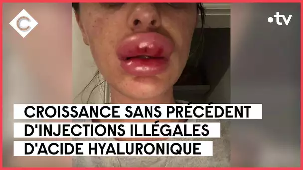 L’alerte des chirurgiens sur les injections illégales - C à Vous - 30/03/2023