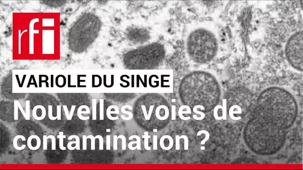 Variole du singe : doit-on craindre une nouvelle pandémie ? • RFI