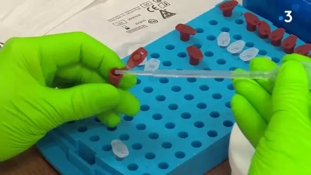 Montpellier : un test salivaire validé par le CHU pour le dépistage du Covid-19