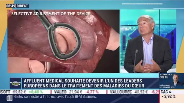 Michel Finance (Affluent Medical): Implantation chez l'homme d'une valve artificielle pour le coeur