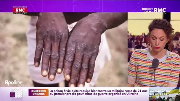 Un premier cas suspect de variole du singe détecté en France