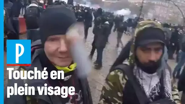 Paris : Manu, victime d'un tir de grenade en plein visage