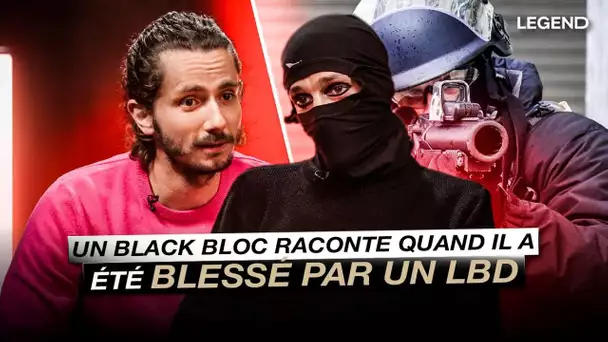 Un Black-Bloc raconte quand il a été blessé par un LBD