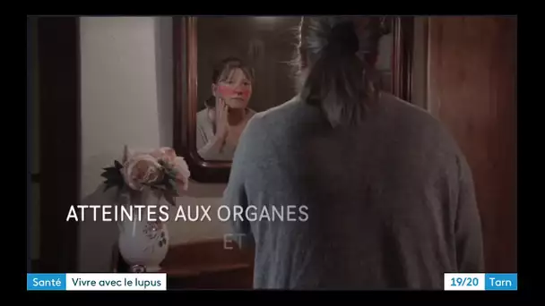 Une vidéo tournée dans le Tarn pour sensibiliser au lupus, maladie méconnue