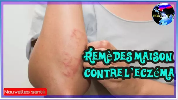 Remèdes maison contre l’eczéma|Nouvelles24h