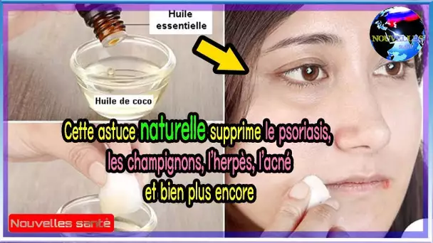 Éliminer le psoriasis, les champignons, l&#039;herpès, l&#039;acné avec cette astuce naturelle