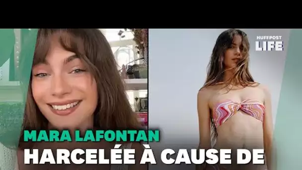 Une mannequin française harcelée à cause de ses poils sur le ventre