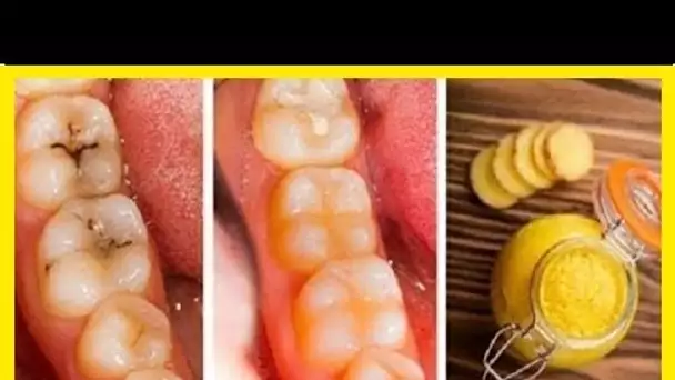 Voici comment guérir les caries et la dégradation des dents naturellement et facilement à la maison