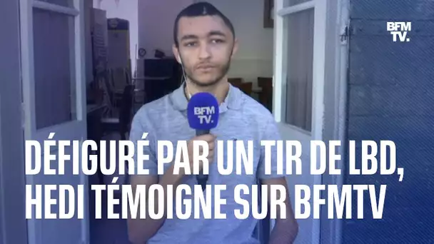 "En aucun cas, je ne faisais partie des émeutes": Hedi, défiguré par un tir de LBD, témoigne