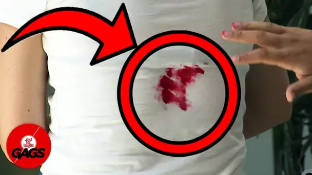 Blessure douloureuse **FAIL** | Juste Pour Rires Les Gags