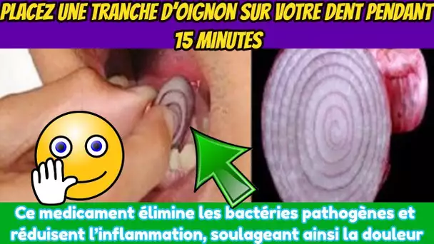 Placez Une Tranche D’oignon Sur Votre Dent Pendant 15 Minutes  Regardez Ce Qui Arrive