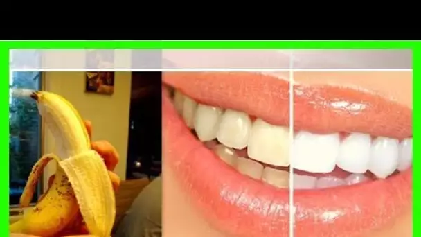 PEAU DE BANANE= DENTS BLANCS