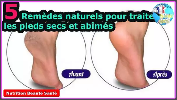 5 Remèdes naturels pour traiter les pieds secs et abîmés|Nutrition Beauté Santé