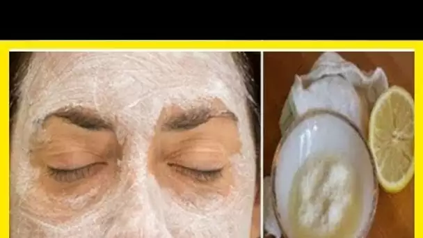 APPLIQUEZ CE MASQUE DE BICARBONATE DE SOUDE ET DE CITRON SUR VOTRE VISAGE ET QUELQUE CHOSE D&#039;EXTRAO