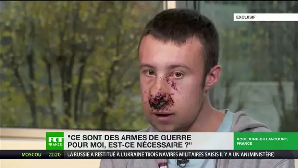 Julien, journaliste indépendant blessé au visage place d'Italie, témoigne