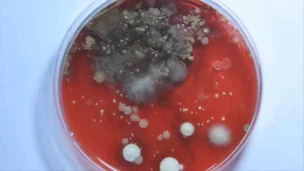 Quels objets du quotidien battent le record de microbes ?
