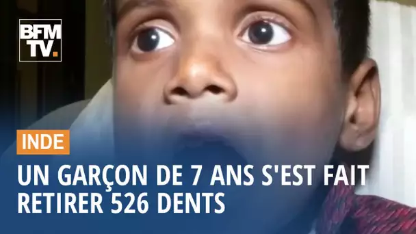 À 7 ans, ce jeune Indien possédait plus de 526 dents