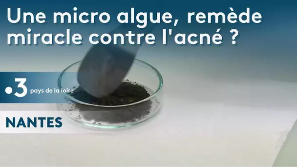 Nantes : une micro algue étudiée par un laboratoire futur remède contre les boutons d'acné ?