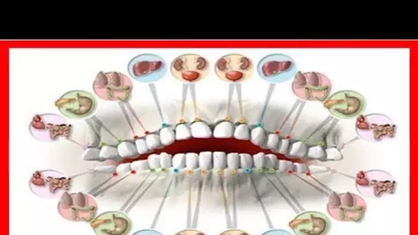 Chaque dent est reliée à un organe – Comment une douleur dentaire peut révéler un problème lié à un