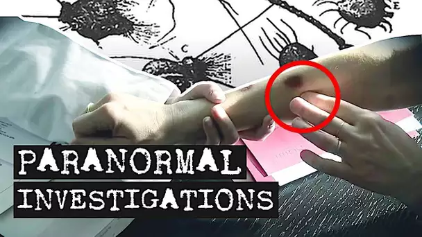 Paranormal Investigations - Maladie étrange et spectaculaire de la peau