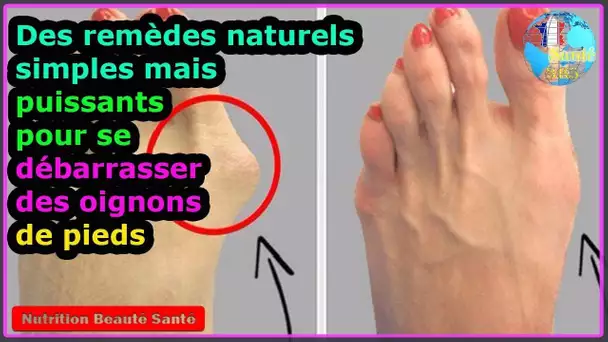 Remèdes naturels simples pour se débarrasser du chignon|Nutrition Beauté Santé