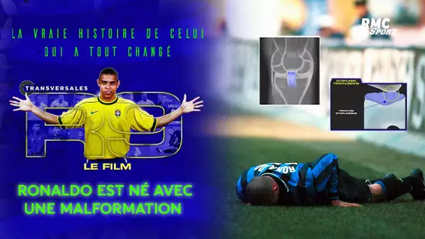 Extrait "R9 le film" : Les malformations aux genoux de Ronaldo imagées et expliquées par son physio
