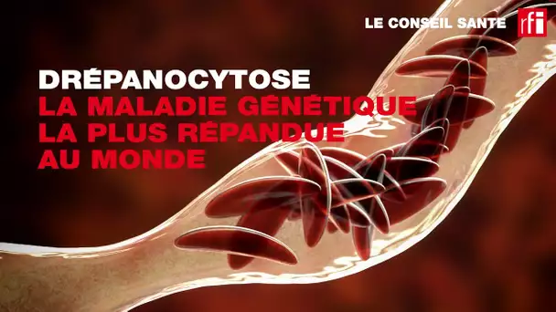 Conseil Santé : l'anémie est le premier signe de la drépanocytose
