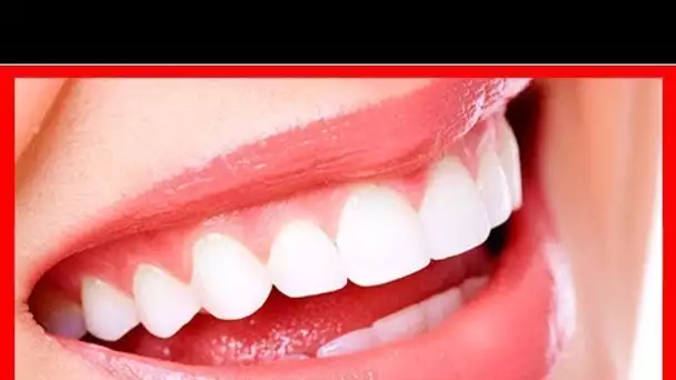 Les aliments qui préservent la santé dentaire et renforcent les dents