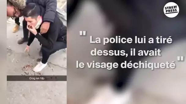 "La police lui a tiré  dessus, il avait  le visage déchiqueté"