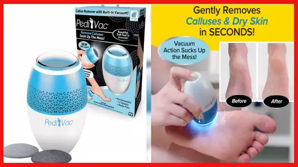 As Seen On TV PediVac Electric Callus Remover + Built-In Vacuum Sucks Up Shavings, New Look, Gently