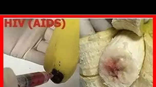 CHOQUANT: BANANES SONT ELLES INJECTÉES AVEC LE VIRUS VIH? VIDÉO À VOIR