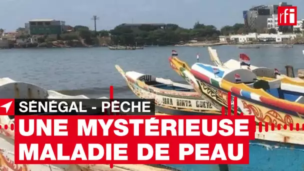 Sénégal : une « mystérieuse maladie » de peau touche des pêcheurs