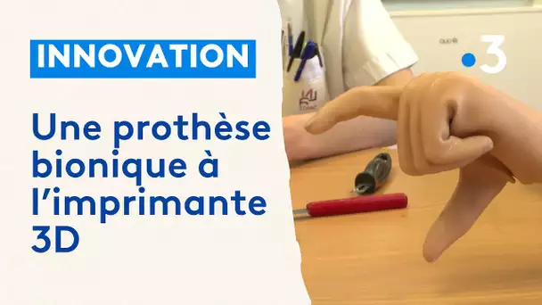 Doté d'une prothèse bionique innovante, il retrouve l'usage de sa main