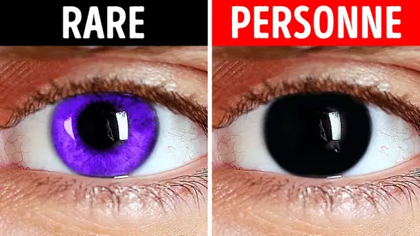 Pourquoi ne pouvez-vous pas avoir les yeux noirs et d'autres faits sur le corps ?