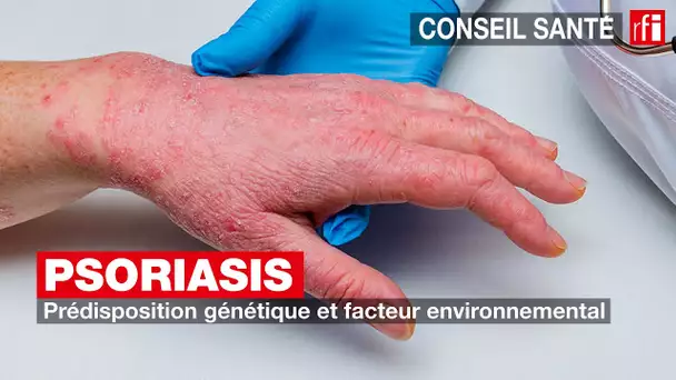 Psoriasis : prédisposition génétique et facteur environnemental #conseilsanté