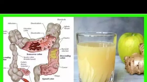 Le jus de nettoyage du côlon à 3 ingrédients : Comment les pommes, le gingembre et le citron peuven