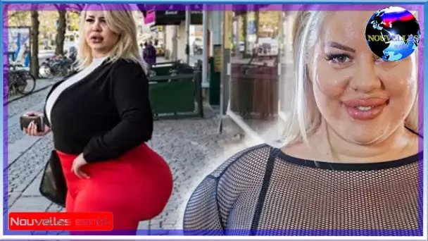 Ce mannequin veut subir une chirurgie dangereuse pour avoir les plus grosses fesses du monde