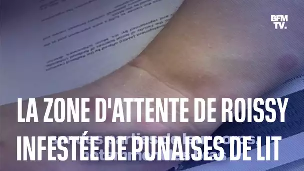 La zone d'attente de l'aéroport Roissy-Charles-de-Gaulle infestée de punaises de lit